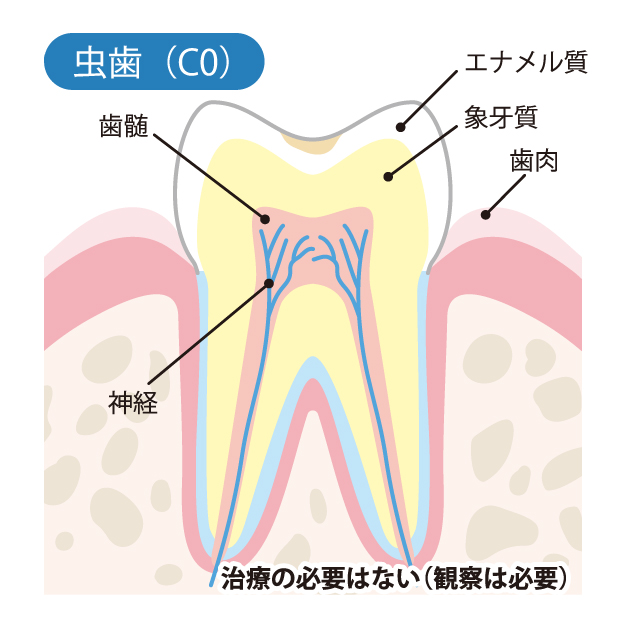 藤が丘駅徒歩1分の歯医者、マイデンタルオフィス藤が丘のなるべく削らず、痛くない治療