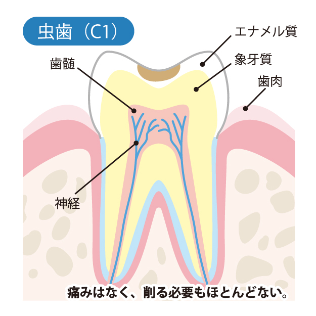 藤が丘駅徒歩1分の歯医者、マイデンタルオフィス藤が丘のなるべく削らず、痛くない治療