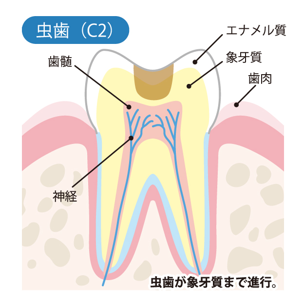 藤が丘駅徒歩1分の歯医者、マイデンタルオフィス藤が丘のなるべく削らず、痛くない治療