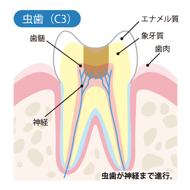 藤が丘駅徒歩1分の歯医者、マイデンタルオフィス藤が丘のなるべく削らず、痛くない治療