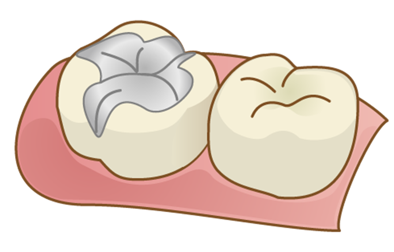 マイデンタルオフィス藤が丘の料金表