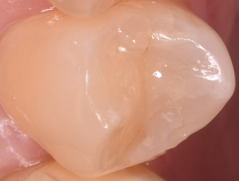 マイデンタルオフィス藤が丘の料金表