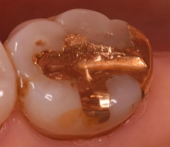 マイデンタルオフィス藤が丘の料金表