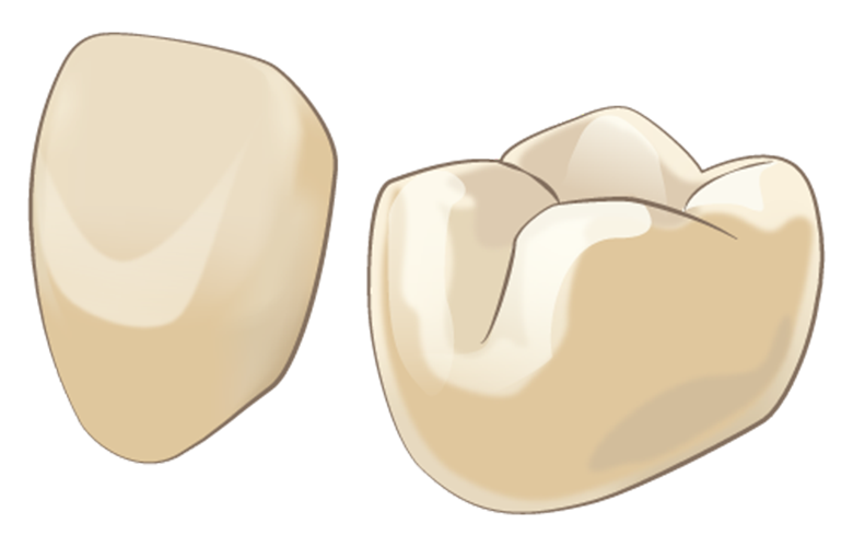 マイデンタルオフィス藤が丘の料金表