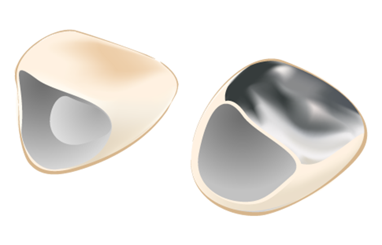 マイデンタルオフィス藤が丘の料金表