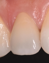 マイデンタルオフィス藤が丘の料金表