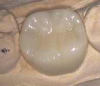 マイデンタルオフィス藤が丘の料金表