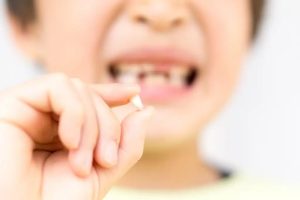 藤が丘駅徒歩1分の歯医者「マイデンタルオフィス藤が丘」で子供の顎関節症について解説