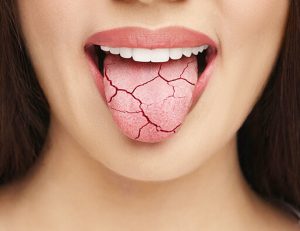 藤が丘駅徒歩1分の歯医者「マイデンタルオフィス藤が丘」で思春期の口臭の原因について解説